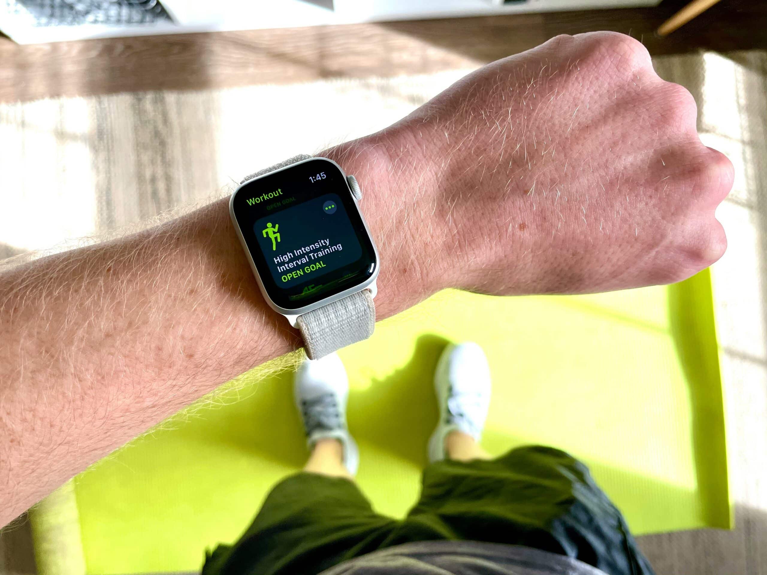 Smartwatch. Foto: Unsplash